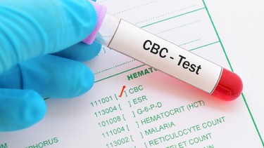 Cách đọc kết quả xét nghiệm máu và một số lưu ý cần biết