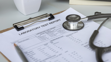 Cách đọc kết quả xét nghiệm toxocara: Hướng dẫn dễ hiểu, tránh hiểu nhầm