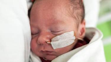 Chăm sóc trẻ sau mổ tim bẩm sinh như thế nào để phục hồi nhanh và an toàn?