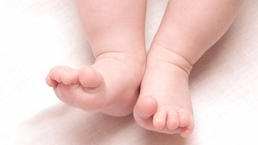 Chân vòng kiềng ở trẻ: Dấu hiệu, nguyên nhân và cách khắc phục hiệu quả