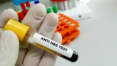 Chỉ số Anti-HBs là gì? Cách tăng chỉ số Anti-HBs