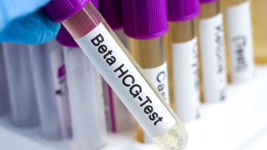 Chỉ số beta hCG thai 4 tuần bao nhiêu là bình thường? Những điều cần biết về chỉ số beta hCG