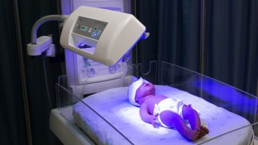 Chiếu đèn vàng da là gì? Cách thực hiện và lưu ý an toàn cho trẻ sơ sinh