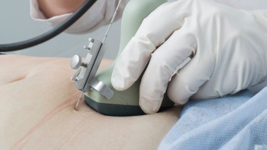 Chọc ối có đau không? Những điều mẹ bầu cần biết