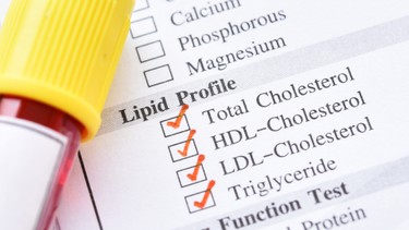 Cholesterol toàn phần là gì​? Tại sao cần kiểm tra định lượng cholesterol toàn phần máu?