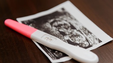 Chửa trứng là gì? Những thông tin cần biết