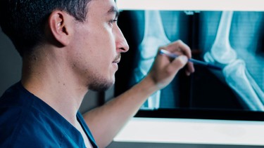 Chụp MRI khớp gối là gì? Khi nào cần chụp và chi phí bao nhiêu?