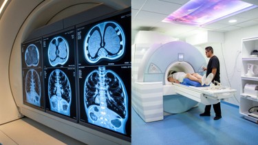 Chụp PET/CT và MRI khác nhau như thế nào? So sánh nguyên lý hoạt động