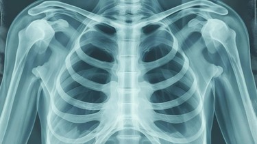 Chụp X-quang có hại không? Tia X ảnh hưởng đến cơ thể như thế nào?