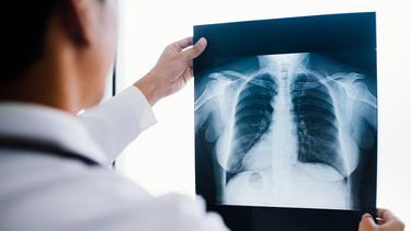 Người bệnh gãy xương sườn bao lâu thì lành?