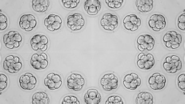 Chuyển phôi: Quy trình, hiệu quả và các yếu tố ảnh hưởng thành công