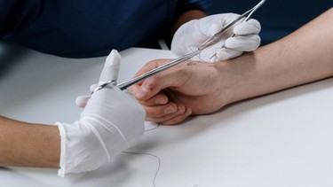 Có cách làm xẹp sẹo phì đại không? Phương pháp giảm nguy cơ hình thành sẹo phì đại