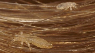 Con chấy là gì? Nguyên nhân và cách phòng ngừa chấy ở trẻ