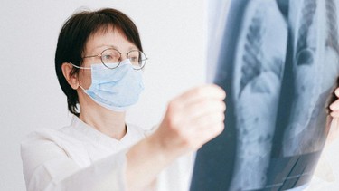 Xét nghiệm ung thư phổi bao gồm những loại nào?