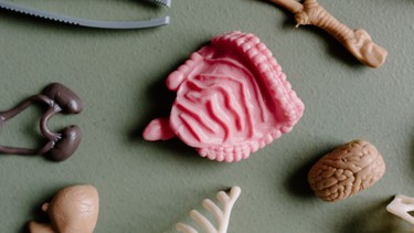 Đa polyp đại tràng là gì? Những vấn đề cần biết về đa polyp đại tràng