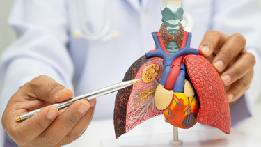 Đã tiêm 6 trong 1 có cần tiêm phế cầu không? Nên tiêm chung hay tiêm riêng?