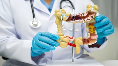 Đại tràng và trực tràng: Cấu trúc, chức năng và các bệnh nguy hiểm liên quan