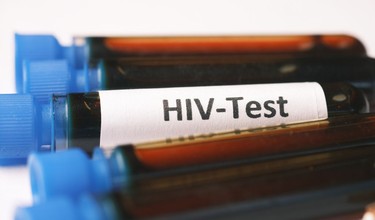 Các dấu hiệu HIV ở nữ giới trong giai đoạn đầu