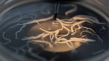 Dấu hiệu nhận biết và thói quen giúp phòng tránh giun tròn