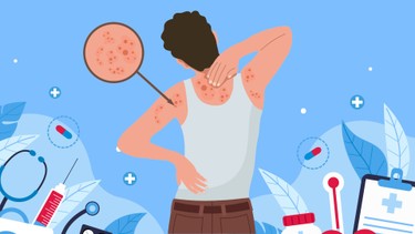 Đau sau zona có phải chỉ là “chuyện nhỏ” như nhiều người vẫn nghĩ?