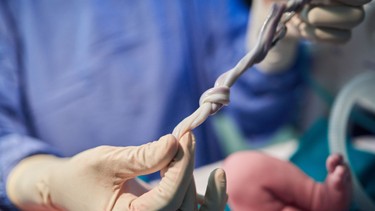 Dây rốn bám lệch tâm là gì? Những điều mẹ bầu cần biết