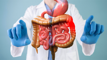 Dị sản ruột dạ dày là gì? Triệu chứng, nguyên nhân, chẩn đoán và điều trị