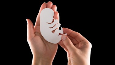 Dị tật thai là gì? Những vấn đề cần biết về dị tật thai