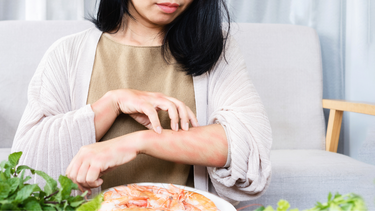 Làm sao để hết mề đay mãn tính?