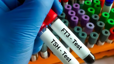 Định lượng FT3 giúp đánh giá sớm rối loạn tuyến giáp