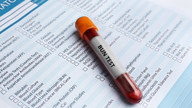 Định lượng ure máu​ là gì? Những trường hợp nào ure máu thay đổi?