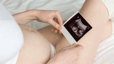 Độ mờ da gáy cao nhưng NIPT bình thường có nguy hiểm không?