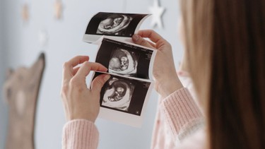 Độ mờ da gáy là gì? Cách đo độ mờ da gáy