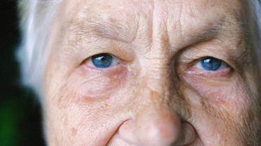 Đục thủy tinh thể: Hiểu đúng để không mất đi ánh sáng đôi mắt
