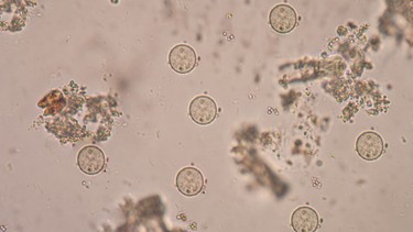 E. histolytica là gì? Nguyên nhân, triệu chứng và cách phòng ngừa hiệu quả