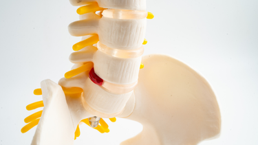 Gai cột sống nên ăn gì? Thực phẩm nên và không nên ăn cần biết