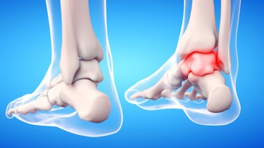 Giải phẫu cổ chân: Cấu trúc và các tổn thương thường gặp