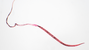 Giun tóc là gì? Đặc điểm, cách lây truyền, triệu chứng và cách phòng ngừa