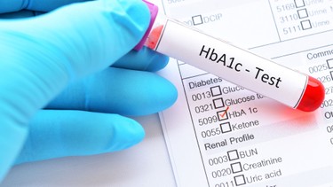 HBA1C là gì? Một số điều bạn cần biết về xét nghiệm HBA1C 