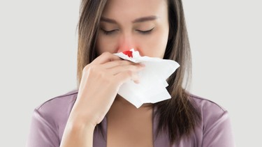 Hỉ mũi ra máu là gì? Nguyên nhân, cách xử lý và cách phòng ngừa