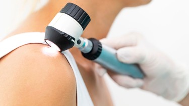 Hình ảnh các bệnh về da liễu và cách nhận biết sớm