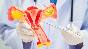 Hội chứng Asherman là gì? Những điều cần biết về hội chứng asheman