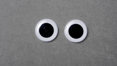 Hội chứng Parinaud: Triệu chứng, nguyên nhân và cách phát hiện sớm