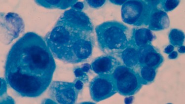 Homocysteine là gì? Ý nghĩa chỉ số homocysteine mà bạn cần biết