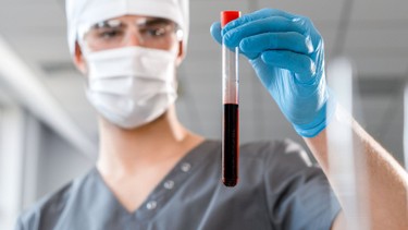 Huyết thanh và huyết tương: Phân biệt đúng trong y khoa