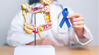 Kết quả sinh thiết polyp đại tràng cho biết điều gì?