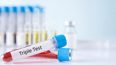 Kết quả xét nghiệm Triple Test: Cách đọc, ý nghĩa và hướng xử trí