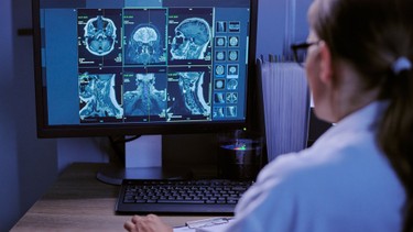 Khám thiểu năng tuần hoàn não ở đâu để đảm bảo chính xác?