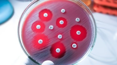 Kháng sinh đồ là gì? Vai trò của kháng sinh đồ trong giảm đề kháng kháng sinh