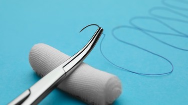 Khâu chỉ tự tiêu sau sinh bao lâu thì hết? Thông tin mẹ cần biết