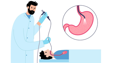 Khoảng cách giữa 2 lần nội soi dạ dày là bao lâu? Vì sao không nên nội soi thường xuyên?